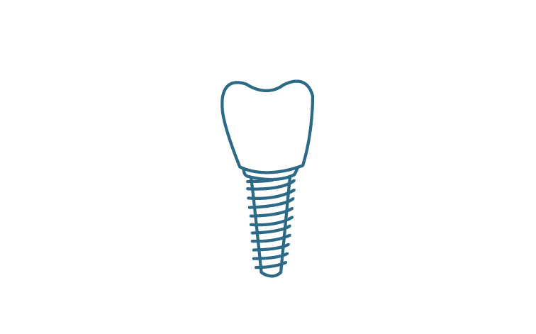 single-implant