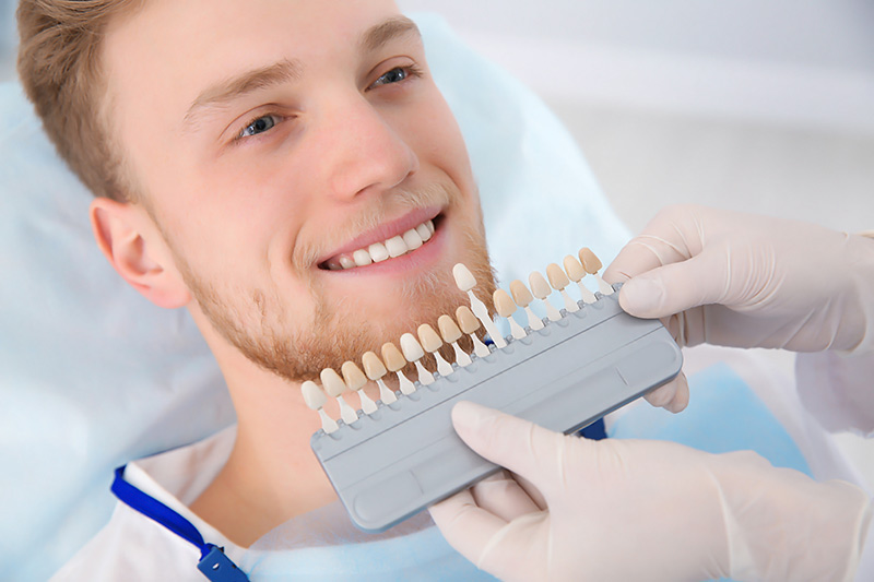 Crown Clinic London - Dental Veneers