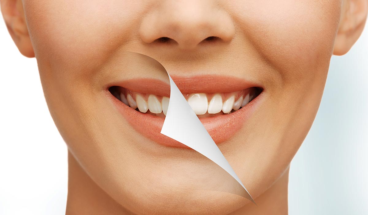 Cosmetic Dentistry - Crown Clinic London in Putney