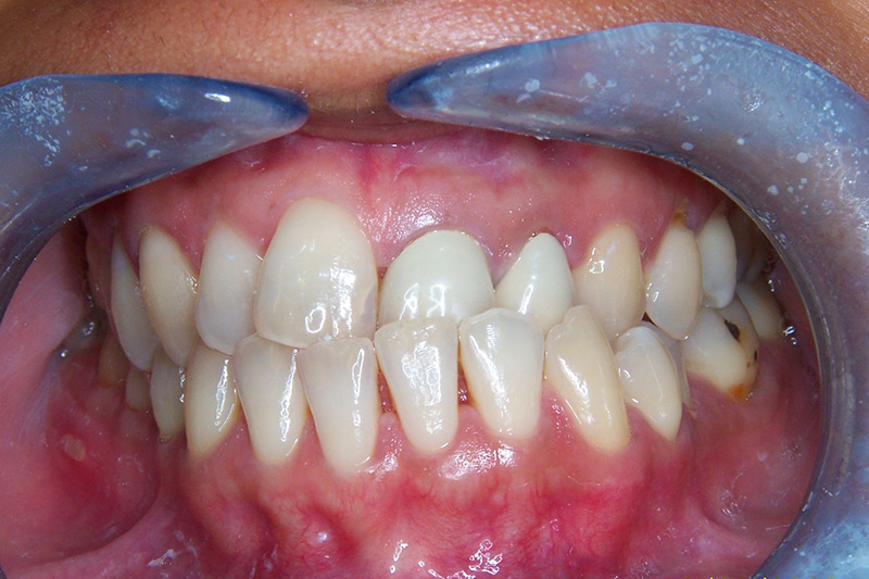 Crown Clinic London – Advanced Orthodontic Treatment Crown Clinic London - Advanced Orthodontic Treatment