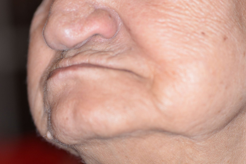 Crown Clinic London – Dental Face Lift Crown Clinic London - Dental Face Lift
